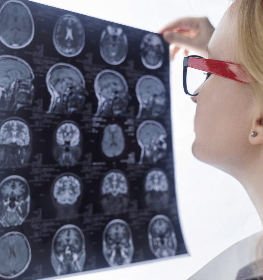 doctor with red glasses examining brain scans